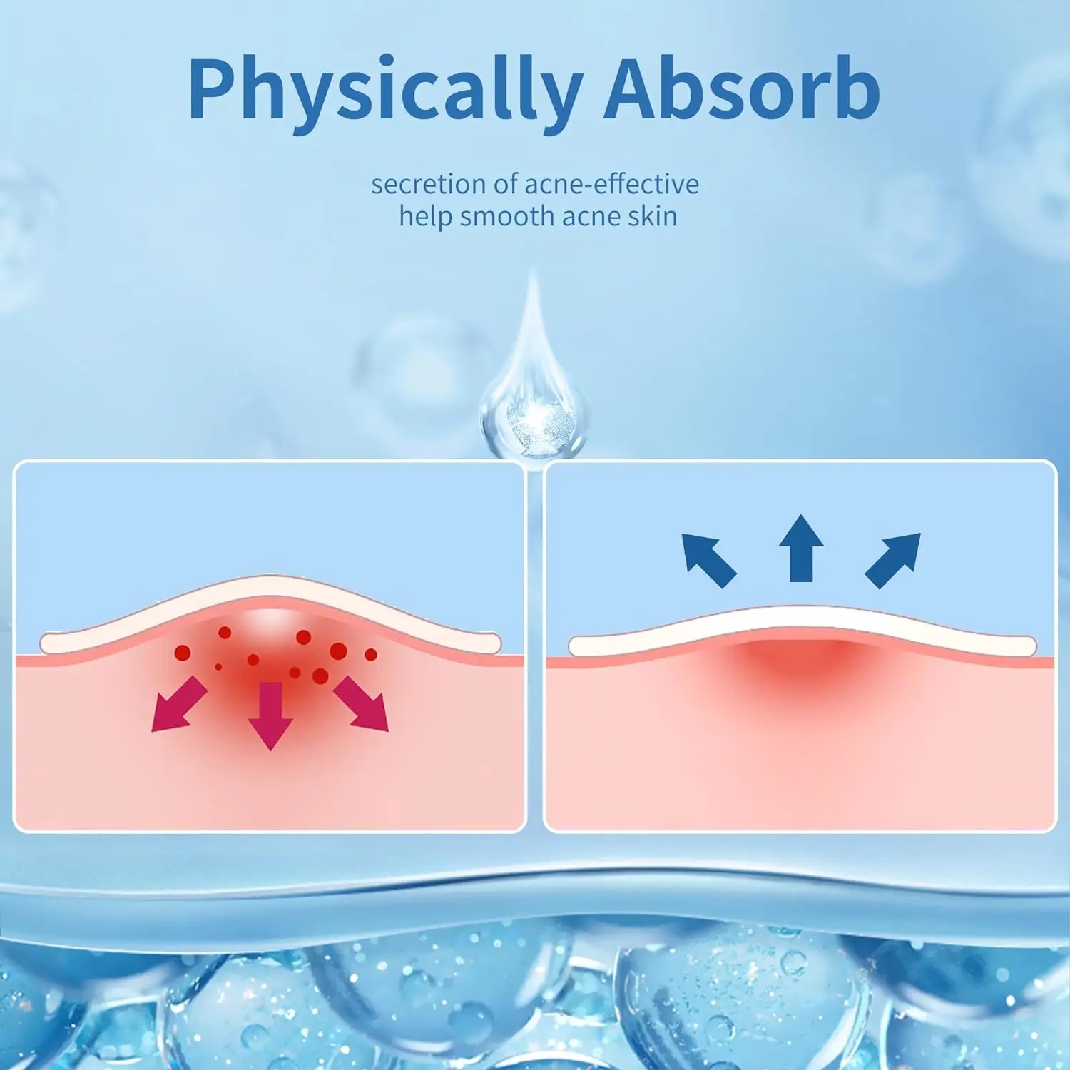 AliExpress 360-Piece Invisible Pimple Patches, view 5