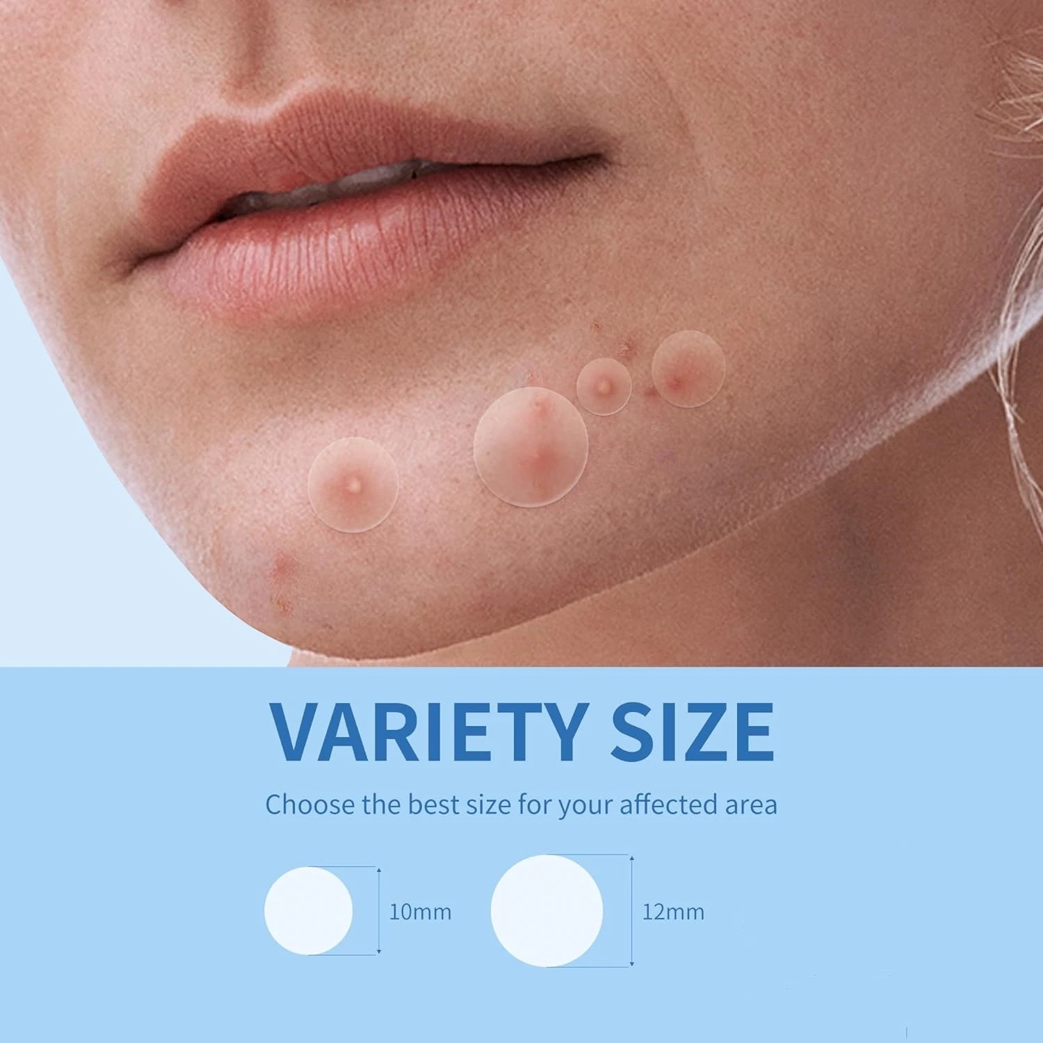 AliExpress 360-Piece Invisible Pimple Patches, view 6