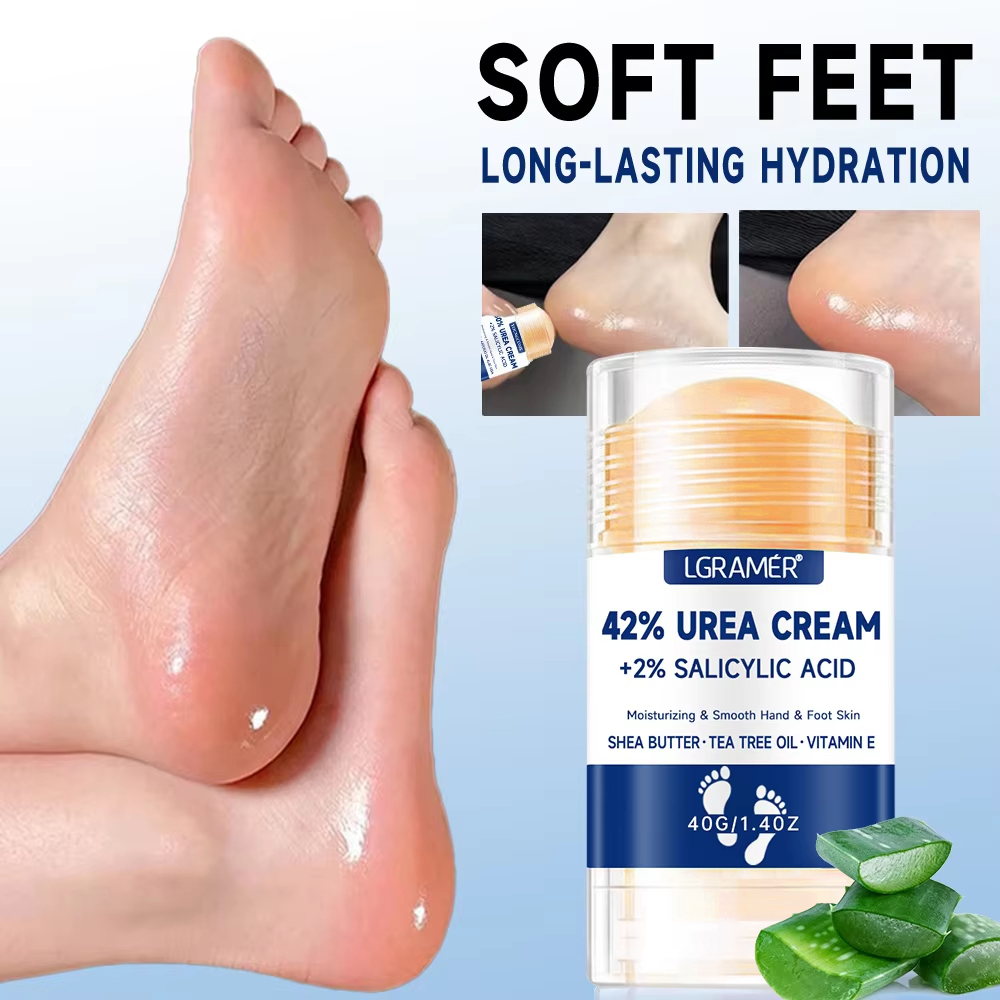 AliExpress Urea Foot and Hand Cream with Salicylic Acid (42%)
