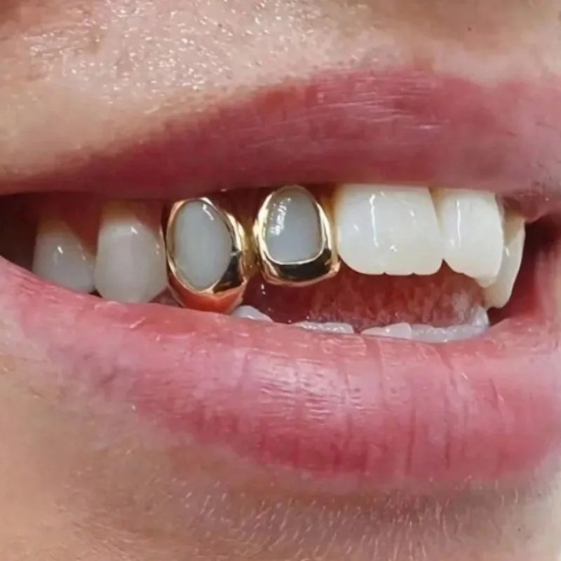 AliExpress Golden Grillz Heart Tooth Jewelry Set, view 4