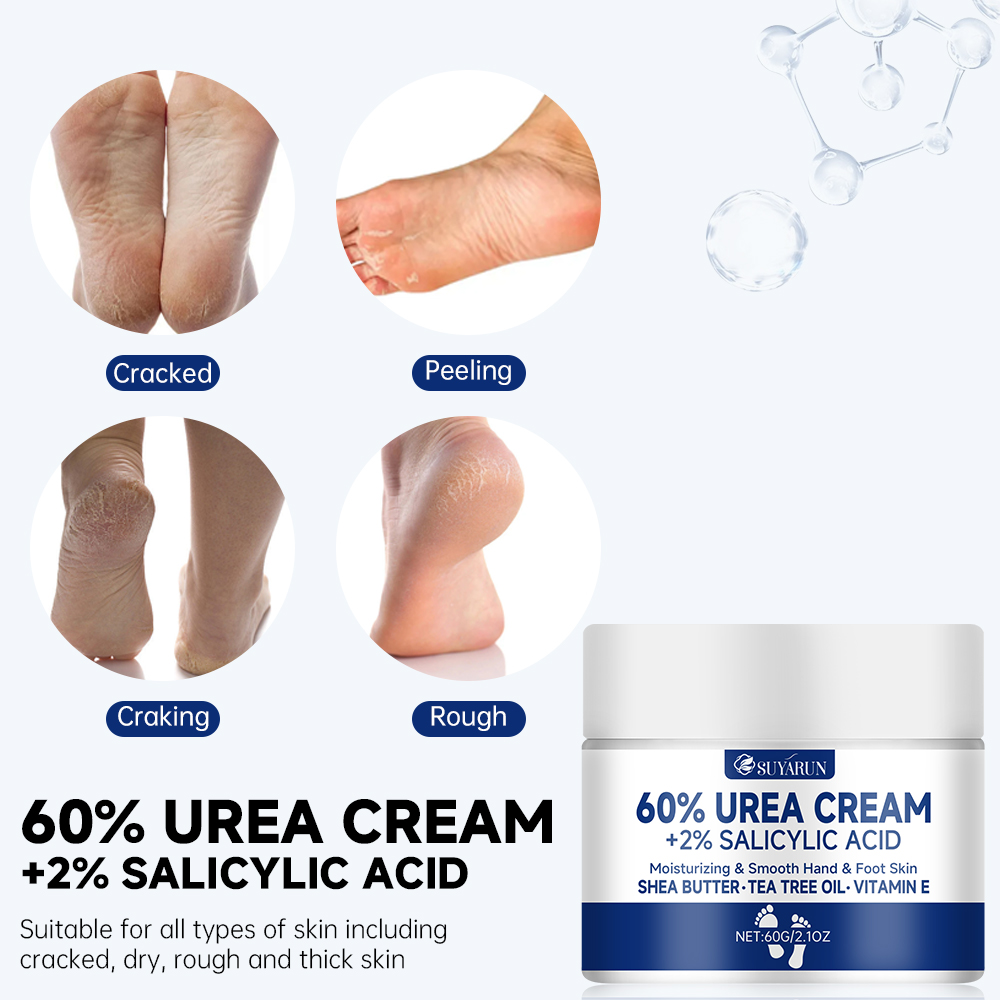 AliExpress SUYARUN 60% Urea Foot Cream for Cracked Heels, view 5
