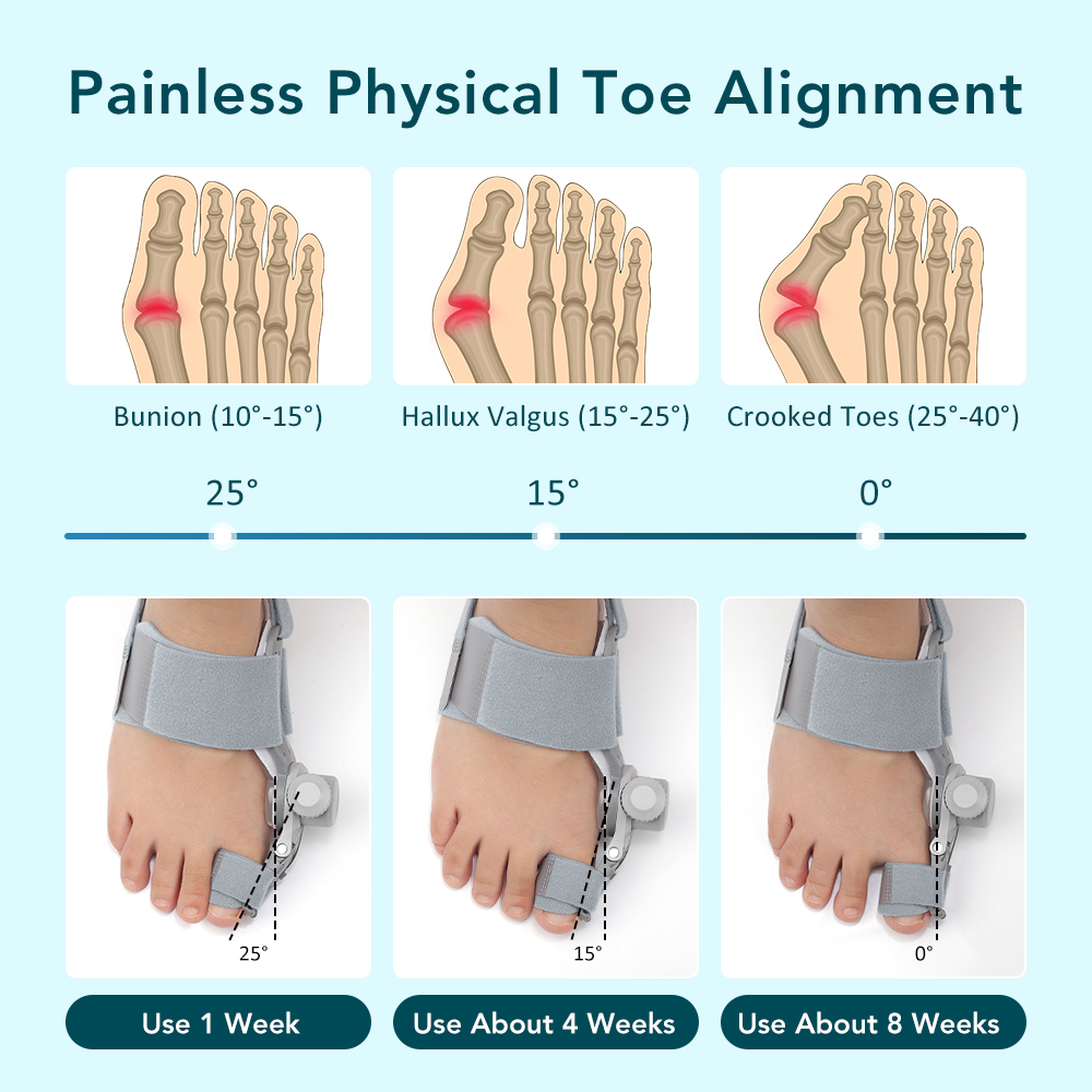 AliExpress Toe Adjuster Orthotics Bone Thumb Adjustable Hammer Protector Hallux Valgus Adjuster Bunion Adjuster Orthopedic Tool Care, view 2