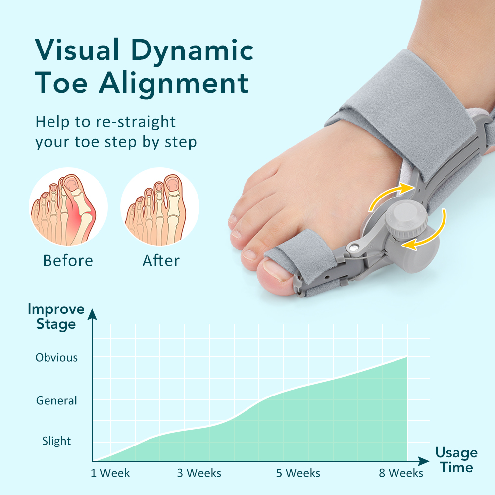 AliExpress Toe Adjuster Orthotics Bone Thumb Adjustable Hammer Protector Hallux Valgus Adjuster Bunion Adjuster Orthopedic Tool Care, view 5