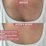 CocoBeauty Bio-Collagen Chest Patches, view 4