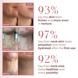 CocoBeauty BioCollagen Neck Patches, view 2