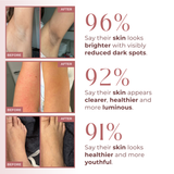 CocoBeauty Body Peel Spray - Kojic + Turmeric, view 2