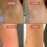 CocoBeauty Body Spray - Kojic + Turmeric, view 6