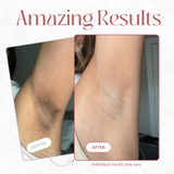 CocoBeauty Peel Shot - Kojic + Turmeric Body Peel Spray, view 4