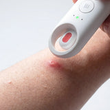 iHealth Labs iHealth D-Itch Stick Bug Bite Healer, view 6