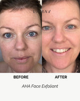 LAMAV AHA Face Exfoliant, view 3