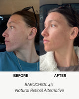 LAMAV BAKUCHIOL 4% Natural Retinol Alternative, view 3