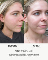 LAMAV BAKUCHIOL 4% Natural Retinol Alternative, view 4