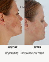 LAMAV Brightening - Skin Discovery Pack, view 3