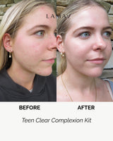 LAMAV Teen Clear Complexion Kit, view 2