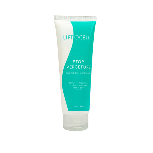 MyTindy Anti Stretch Mark Cream 125ml