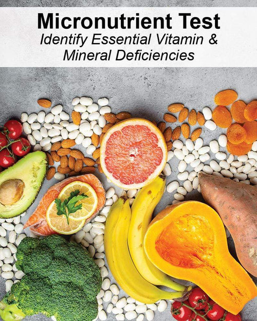 NuVision Health Center Micronutrient Test