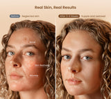 Renpho Artemis LED Light Therapy Mask, view 5